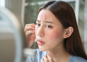 Kulit Kering Karena Kebanyakan Nonton Drakor? Ini Cara Mengatasinya!